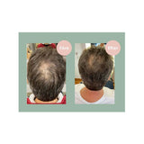 Hair Growth Balsam 250ml