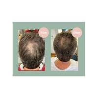 Hair Growth Balsam 250ml