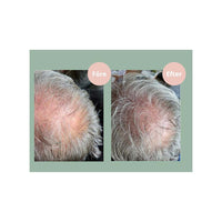 Hair Growth Balsam 250ml